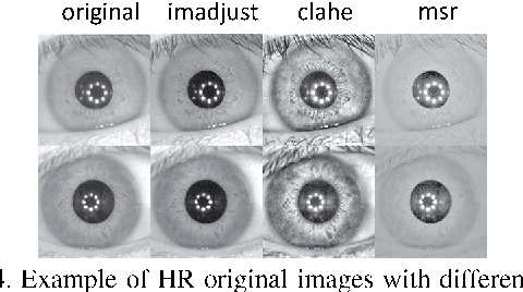 Figure 3 for Very Low-Resolution Iris Recognition Via Eigen-Patch Super-Resolution and Matcher Fusion