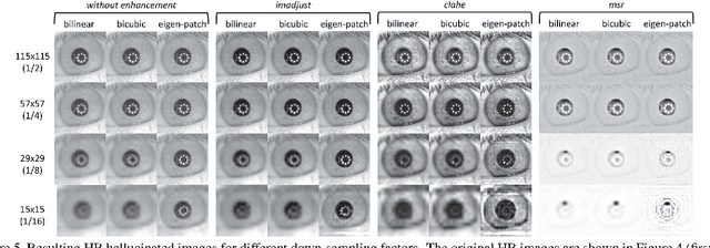 Figure 4 for Very Low-Resolution Iris Recognition Via Eigen-Patch Super-Resolution and Matcher Fusion