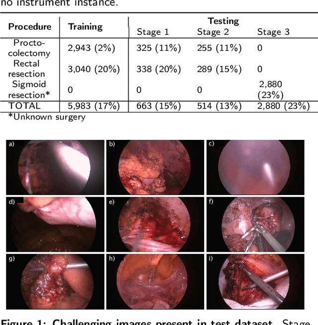 Figure 1 for Real-time Instance Segmentation of Surgical Instruments using Attention and Multi-scale Feature Fusion