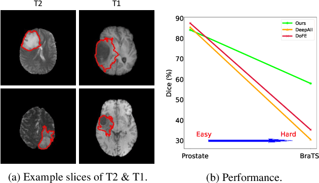 Figure 1 for Generalizable Cross-modality Medical Image Segmentation via Style Augmentation and Dual Normalization