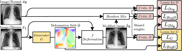 Figure 1 for Interpretation of Disease Evidence for Medical Images Using Adversarial Deformation Fields