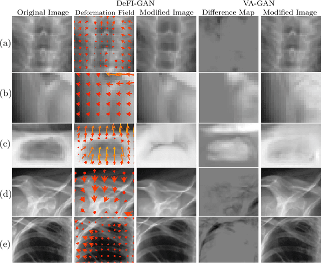 Figure 4 for Interpretation of Disease Evidence for Medical Images Using Adversarial Deformation Fields