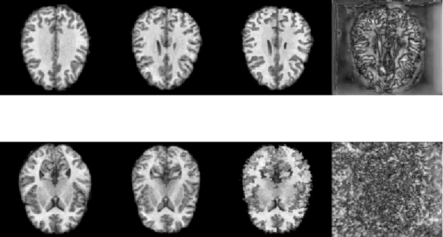 Figure 1 for NPBDREG: A Non-parametric Bayesian Deep-Learning Based Approach for Diffeomorphic Brain MRI Registration