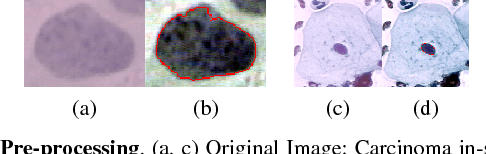 Figure 4 for Considerations for a PAP Smear Image Analysis System with CNN Features