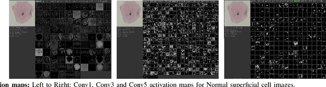 Figure 2 for Considerations for a PAP Smear Image Analysis System with CNN Features