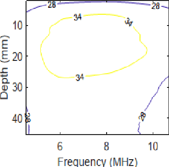 Figure 3 for Physics-Inspired Regularized Pulse-Echo Quantitative Ultrasound: Efficient Optimization with ADMM