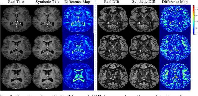 Figure 3 for DiamondGAN: Unified Multi-Modal Generative Adversarial Networks for MRI Sequences Synthesis