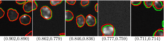 Figure 3 for QANet - Quality Assurance Network for Microscopy Cell Segmentation