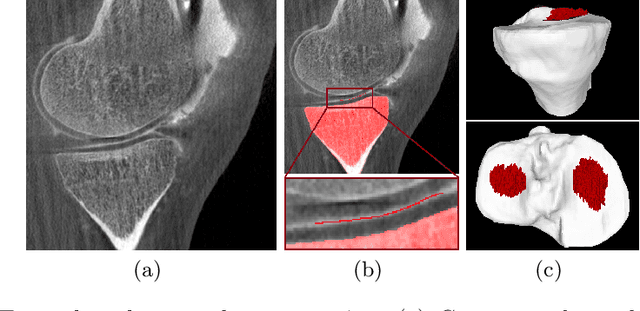 Figure 1 for Multi-Channel Volumetric Neural Network for Knee Cartilage Segmentation in Cone-beam CT
