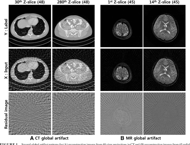 Figure 1 for Deep Learning with Domain Adaptation for Accelerated Projection-Reconstruction MR