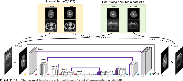 Figure 2 for Deep Learning with Domain Adaptation for Accelerated Projection-Reconstruction MR