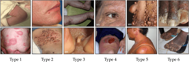 Figure 3 for CIRCLe: Color Invariant Representation Learning for Unbiased Classification of Skin Lesions