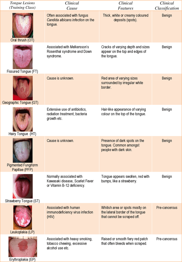 Figure 1 for Automated detection of oral pre-cancerous tongue lesions using deep learning for early diagnosis of oral cavity cancer