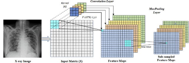 Figure 2 for Towards Clinical Practice: Design and Implementation of Convolutional Neural Network-Based Assistive Diagnosis System for COVID-19 Case Detection from Chest X-Ray Images