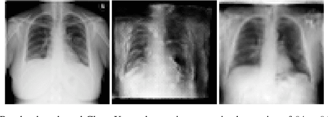 Figure 3 for General-to-Detailed GAN for Infrequent Class Medical Images