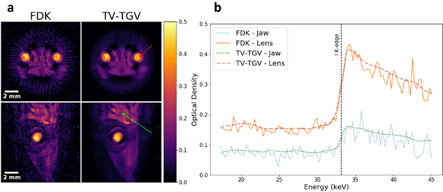 Figure 3 for Enhanced hyperspectral tomography for bioimaging by spatiospectral reconstruction