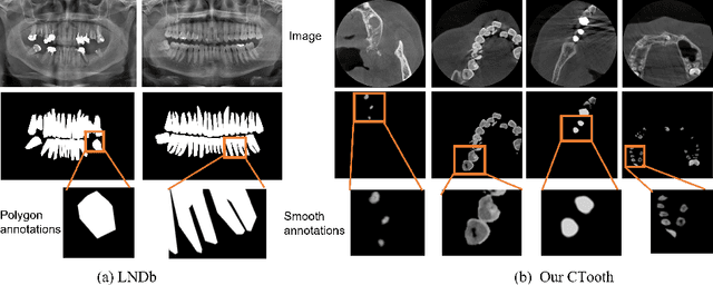 Figure 1 for CTooth: A Fully Annotated 3D Dataset and Benchmark for Tooth Volume Segmentation on Cone Beam Computed Tomography Images