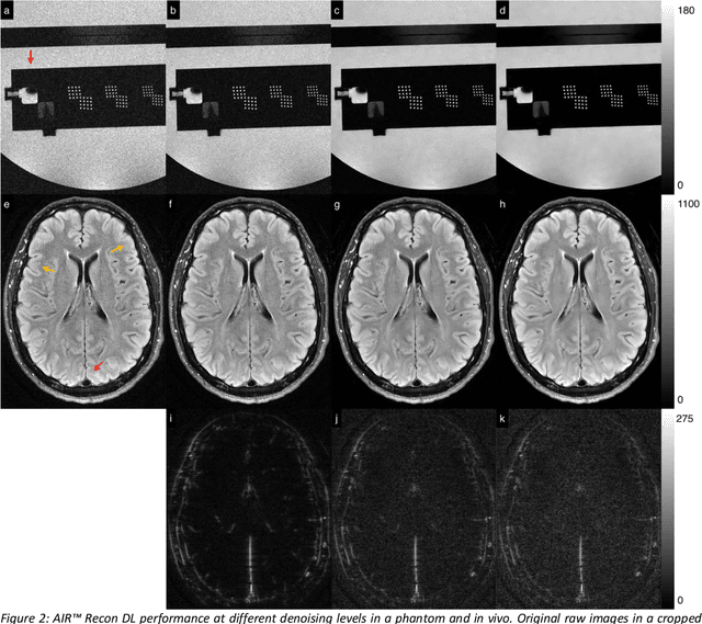 Figure 2 for Performance characterization of a novel deep learning-based MR image reconstruction pipeline