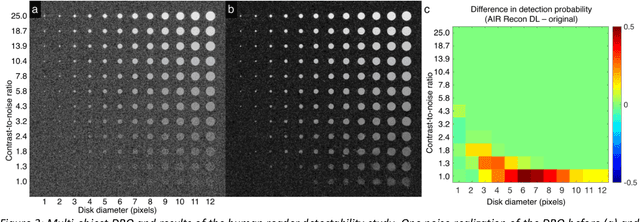Figure 3 for Performance characterization of a novel deep learning-based MR image reconstruction pipeline