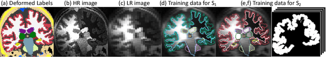 Figure 2 for Robust Segmentation of Brain MRI in the Wild with Hierarchical CNNs and no Retraining