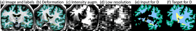 Figure 3 for Robust Segmentation of Brain MRI in the Wild with Hierarchical CNNs and no Retraining