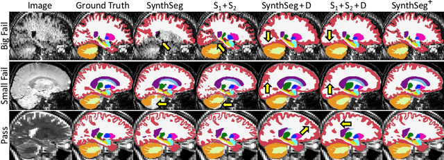 Figure 4 for Robust Segmentation of Brain MRI in the Wild with Hierarchical CNNs and no Retraining
