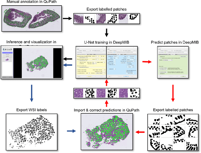 Figure 1 for Code-free development and deployment of deep segmentation models for digital pathology