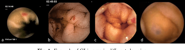 Figure 1 for InvNorm: Domain Generalization for Object Detection in Gastrointestinal Endoscopy