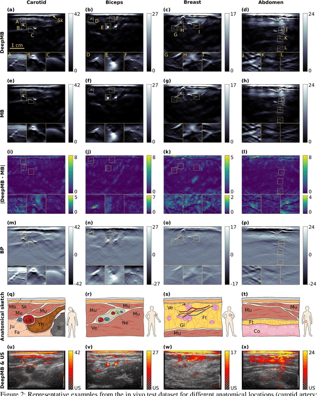 Figure 3 for DeepMB: Deep neural network for real-time model-based optoacoustic image reconstruction with adjustable speed of sound