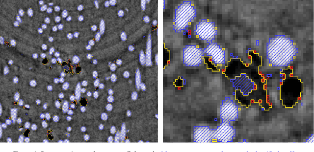 Figure 1 for A modular U-Net for automated segmentation of X-ray tomography images in composite materials