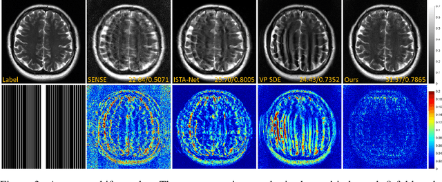 Figure 3 for High-Frequency Space Diffusion Models for Accelerated MRI