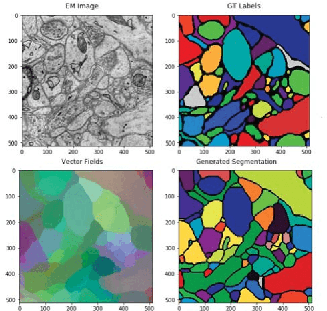 Figure 1 for Learning Metric Graphs for Neuron Segmentation In Electron Microscopy Images