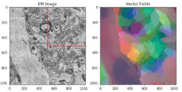 Figure 2 for Learning Metric Graphs for Neuron Segmentation In Electron Microscopy Images