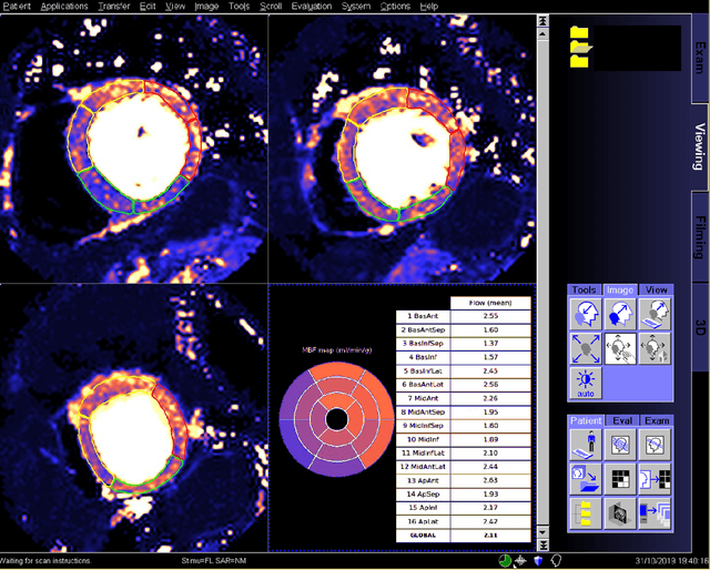 Figure 3 for Automated Inline Analysis of Myocardial Perfusion MRI with Deep Learning