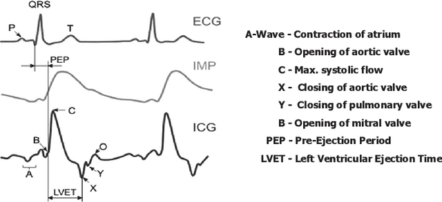 Figure 1 for ReBeatICG: Real-time Low-Complexity Beat-to-beat Impedance Cardiogram Delineation Algorithm