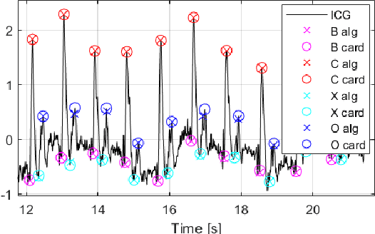 Figure 4 for ReBeatICG: Real-time Low-Complexity Beat-to-beat Impedance Cardiogram Delineation Algorithm