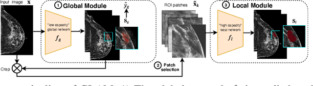 Figure 3 for Weakly-supervised High-resolution Segmentation of Mammography Images for Breast Cancer Diagnosis