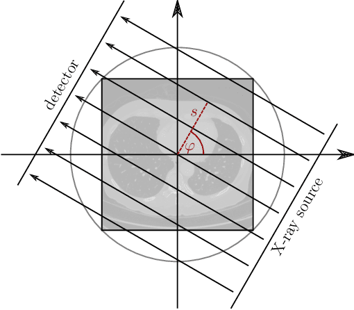 Figure 1 for Computed Tomography Reconstruction Using Deep Image Prior and Learned Reconstruction Methods