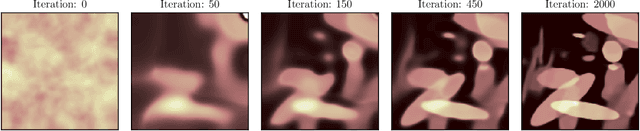 Figure 3 for Computed Tomography Reconstruction Using Deep Image Prior and Learned Reconstruction Methods