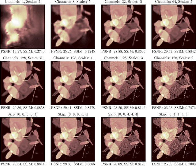 Figure 4 for Computed Tomography Reconstruction Using Deep Image Prior and Learned Reconstruction Methods