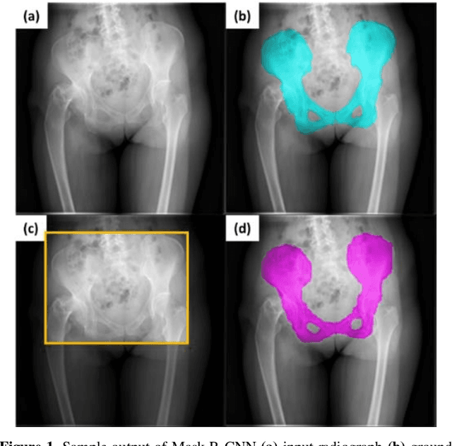 Figure 2 for Region-based Convolution Neural Network Approach for Accurate Segmentation of Pelvic Radiograph