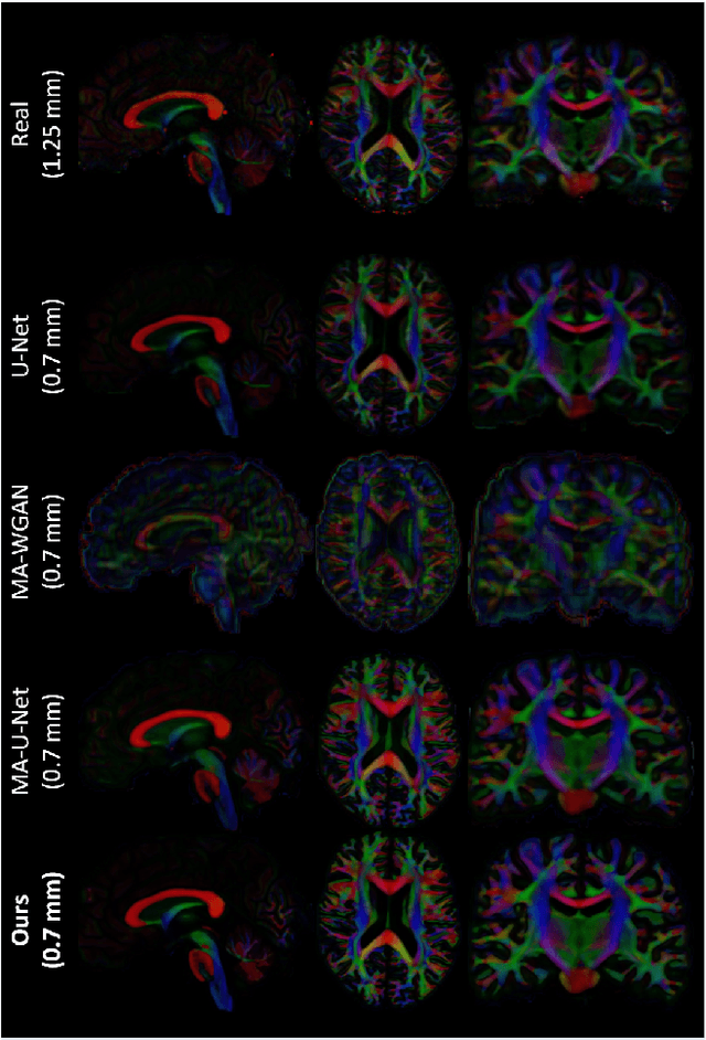 Figure 3 for Manifold-Aware Synthesis of High Resolution Diffusion from Structural Imaging