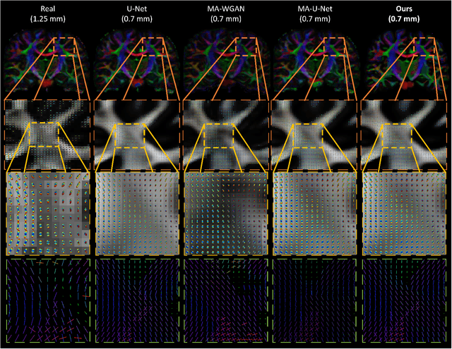 Figure 4 for Manifold-aware Synthesis of High-resolution Diffusion from Structural Imaging