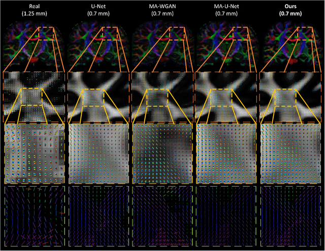 Figure 4 for Manifold-Aware Synthesis of High Resolution Diffusion from Structural Imaging