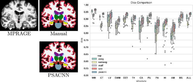 Figure 3 for Pulse Sequence Resilient Fast Brain Segmentation