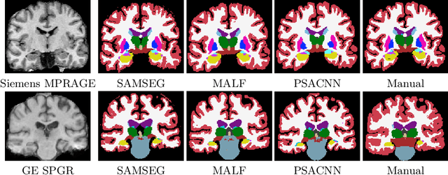 Figure 4 for Pulse Sequence Resilient Fast Brain Segmentation