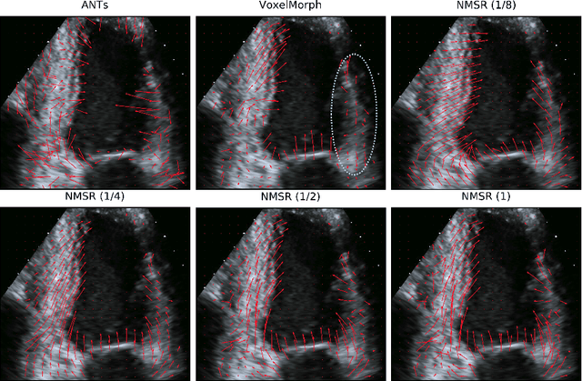 Figure 3 for Neural Multi-Scale Self-Supervised Registration for Echocardiogram Dense Tracking