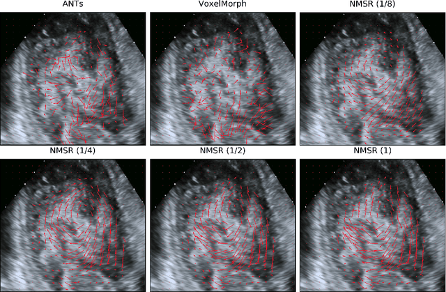 Figure 4 for Neural Multi-Scale Self-Supervised Registration for Echocardiogram Dense Tracking