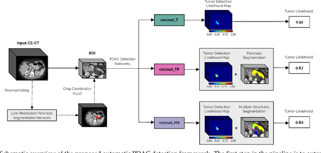 Figure 1 for Fully Automatic Deep Learning Framework for Pancreatic Ductal Adenocarcinoma Detection on Computed Tomography