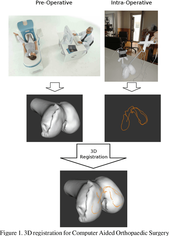 Figure 1 for 3D Registration of Curves and Surfaces using Local Differential Information